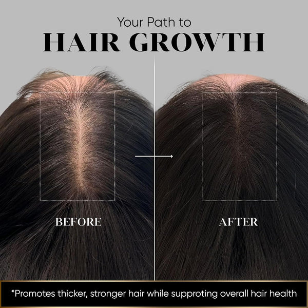 Hadia before and after