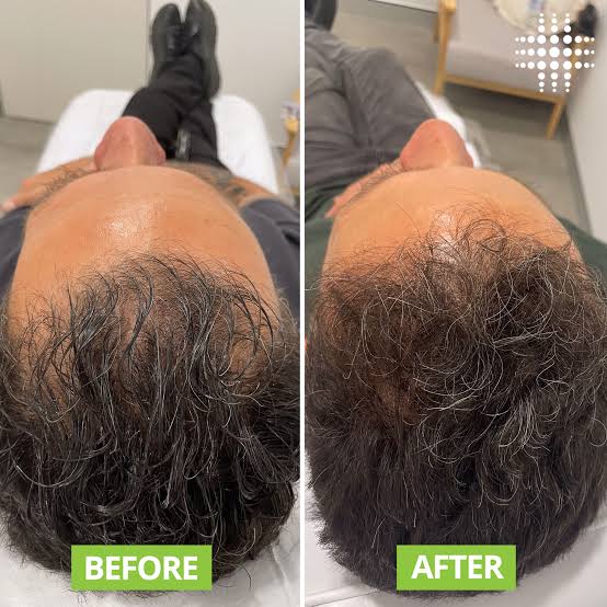 Saba before and after