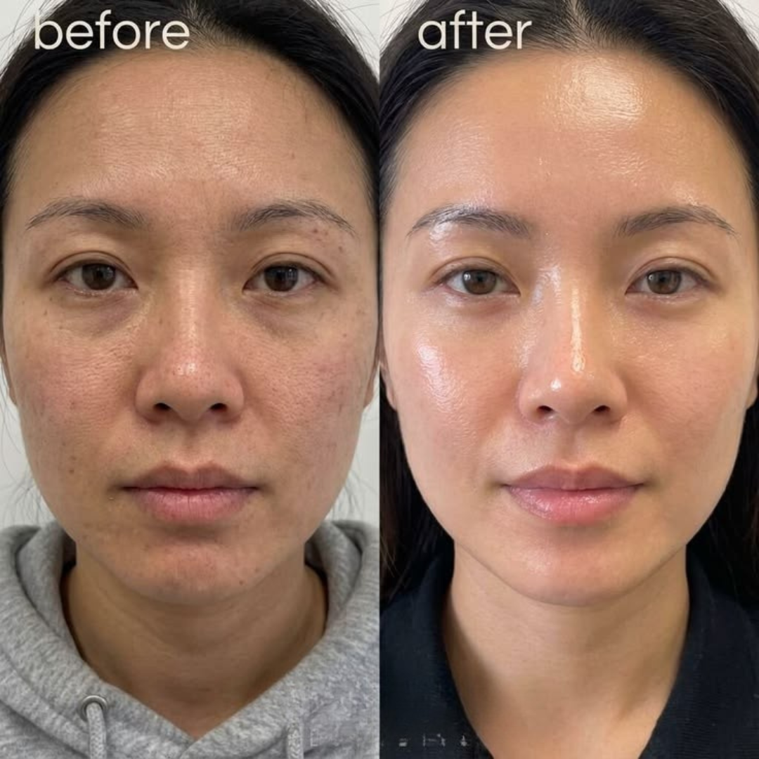 GLAMVEDA Rice & Ceramide Glass Skin Peel-Off Mask – Reveal Smooth, Radiant & Glass-Like Skin – Brightens Dull Skin, Strengthens Barrier, Deeply Hydrates & Nourishes