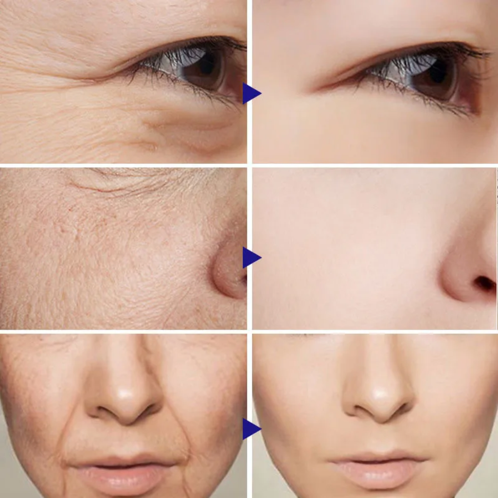 Anti-Wrinkle Firming Cream – Retinol + Peptides + Hyaluronic Acid – Reduces Fine Lines & Wrinkles, Firms & Lifts Skin, Boosts Collagen – For Eyes & Face