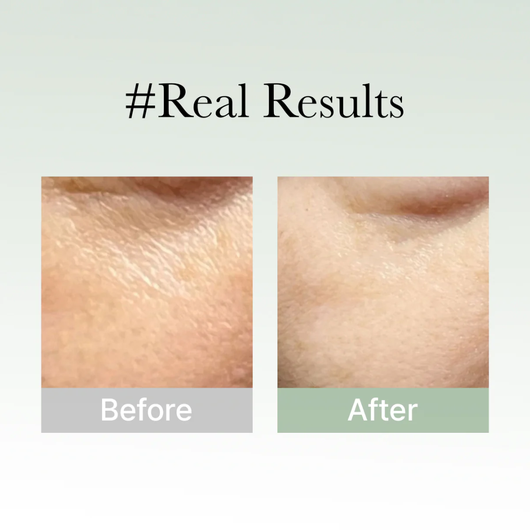 2-in-1 Rice  mask & cleanser (Remove black & white heads , tightening pores and give instant clean & bright skin tone)