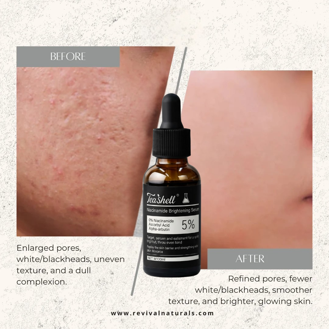 Teashell Niacinamide Brightening Serum | 5% Niacinamide + Alpha-Arbutin + Ascorbyl Acid | Fades Dark Spots, Evens Skin Tone & Boosts Glow