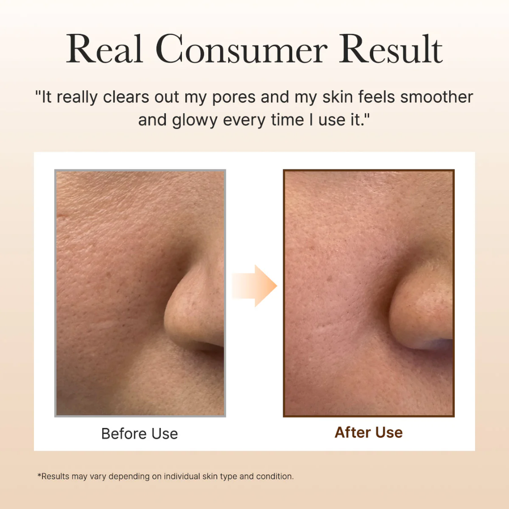 2-in-1 Rice  mask & cleanser (Remove black & white heads , tightening pores and give instant clean & bright skin tone)