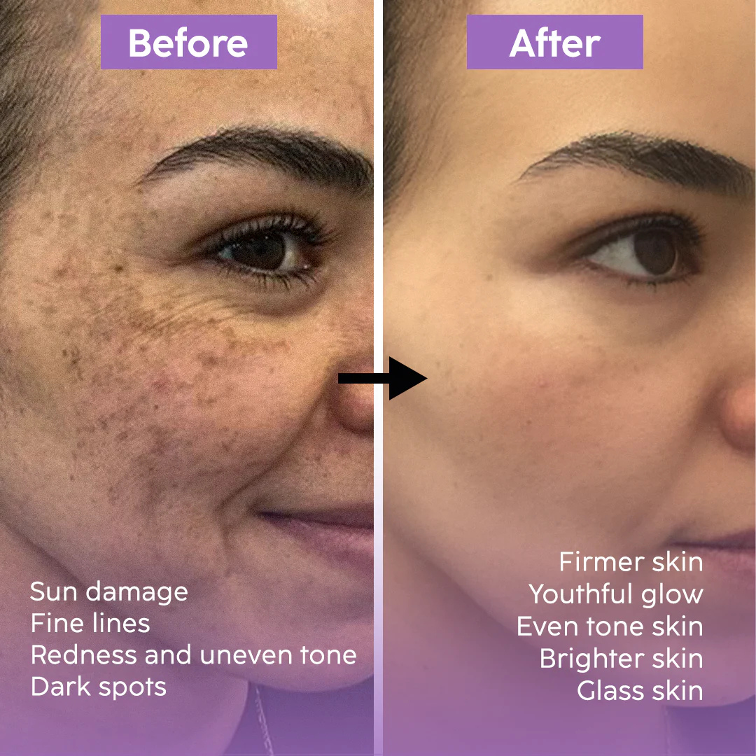 Teashell Niacinamide Brightening Serum | 5% Niacinamide + Alpha-Arbutin + Ascorbyl Acid | Fades Dark Spots, Evens Skin Tone & Boosts Glow