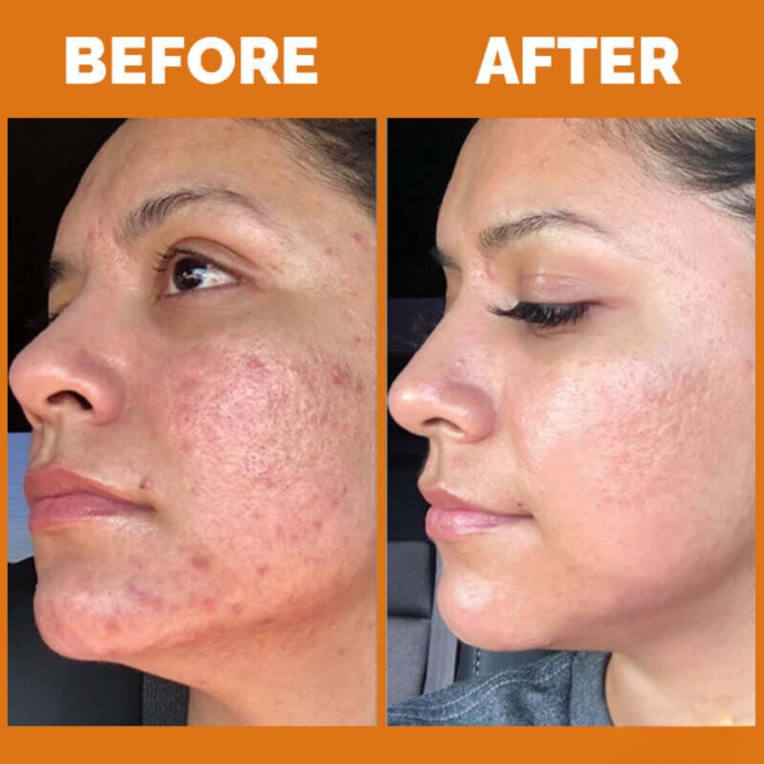 Teashell Niacinamide Brightening Serum | 5% Niacinamide + Alpha-Arbutin + Ascorbyl Acid | Fades Dark Spots, Evens Skin Tone & Boosts Glow
