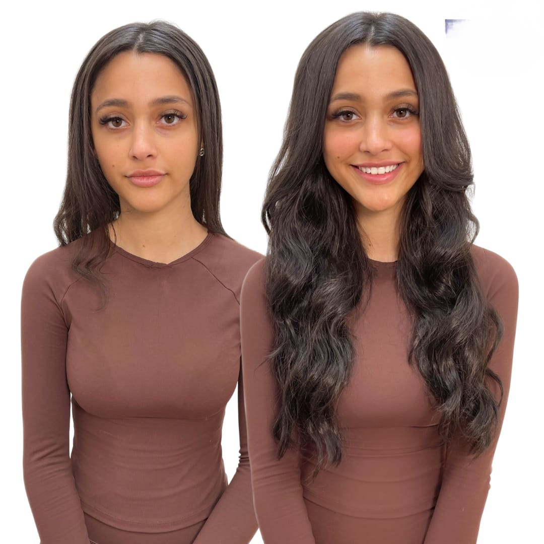 Proskire Hair Growth Serum – Reduces Hair Fall & Boosts Hair Density