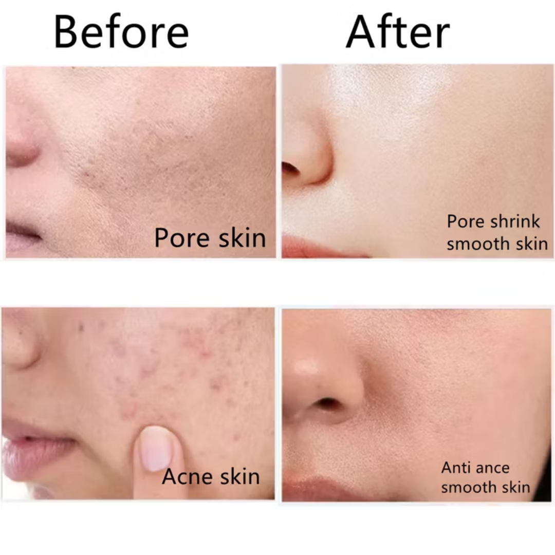 2-in-1 Rice  mask & cleanser (Remove black & white heads , tightening pores and give instant clean & bright skin tone)