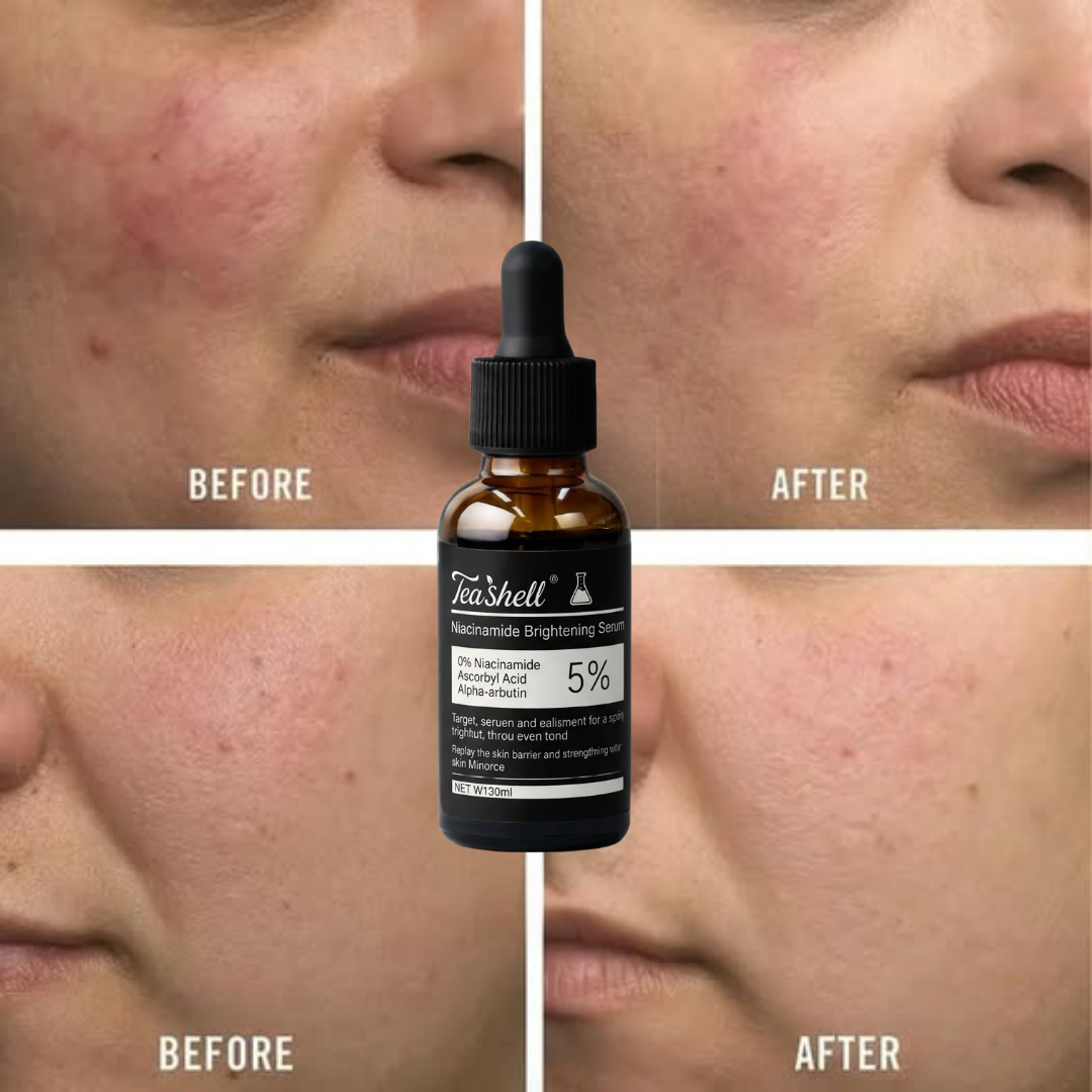 Teashell Niacinamide Brightening Serum | 5% Niacinamide + Alpha-Arbutin + Ascorbyl Acid | Fades Dark Spots, Evens Skin Tone & Boosts Glow
