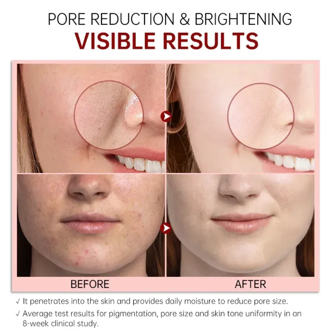 2-in-1 Rice  mask & cleanser (Remove black & white heads , tightening pores and give instant clean & bright skin tone)