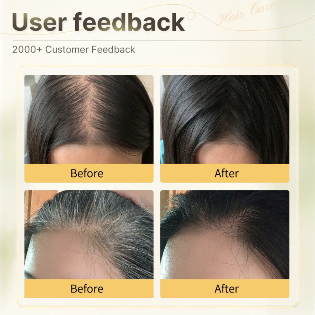 Proskire Anti-Grey Hair Serum – Reverses Grey Hair, Reduces Hair Fall & Restores Hair Color