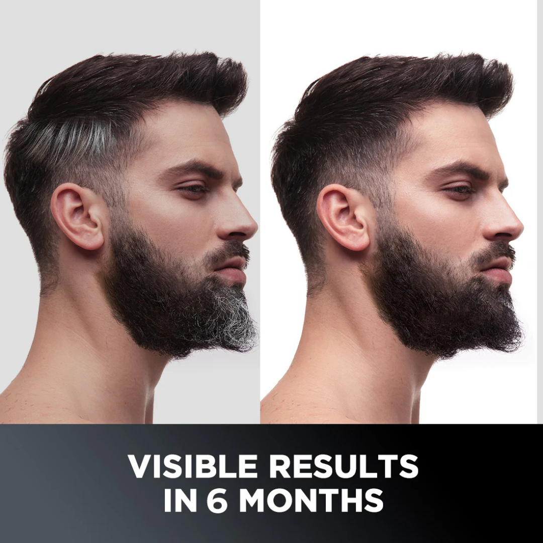 Proskire Anti-Grey Hair Serum – Reverses Grey Hair, Reduces Hair Fall & Restores Hair Color