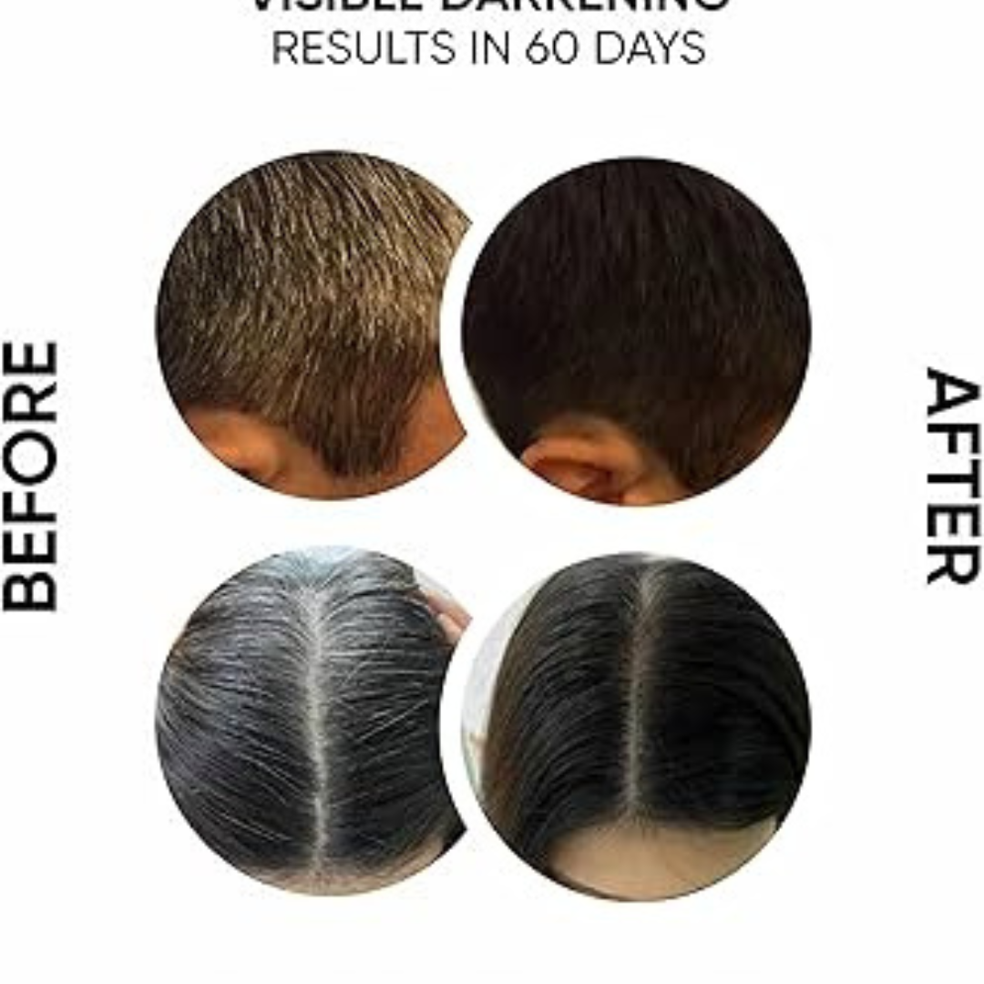 Proskire Anti-Grey Hair Serum – Reverses Grey Hair, Reduces Hair Fall & Restores Hair Color