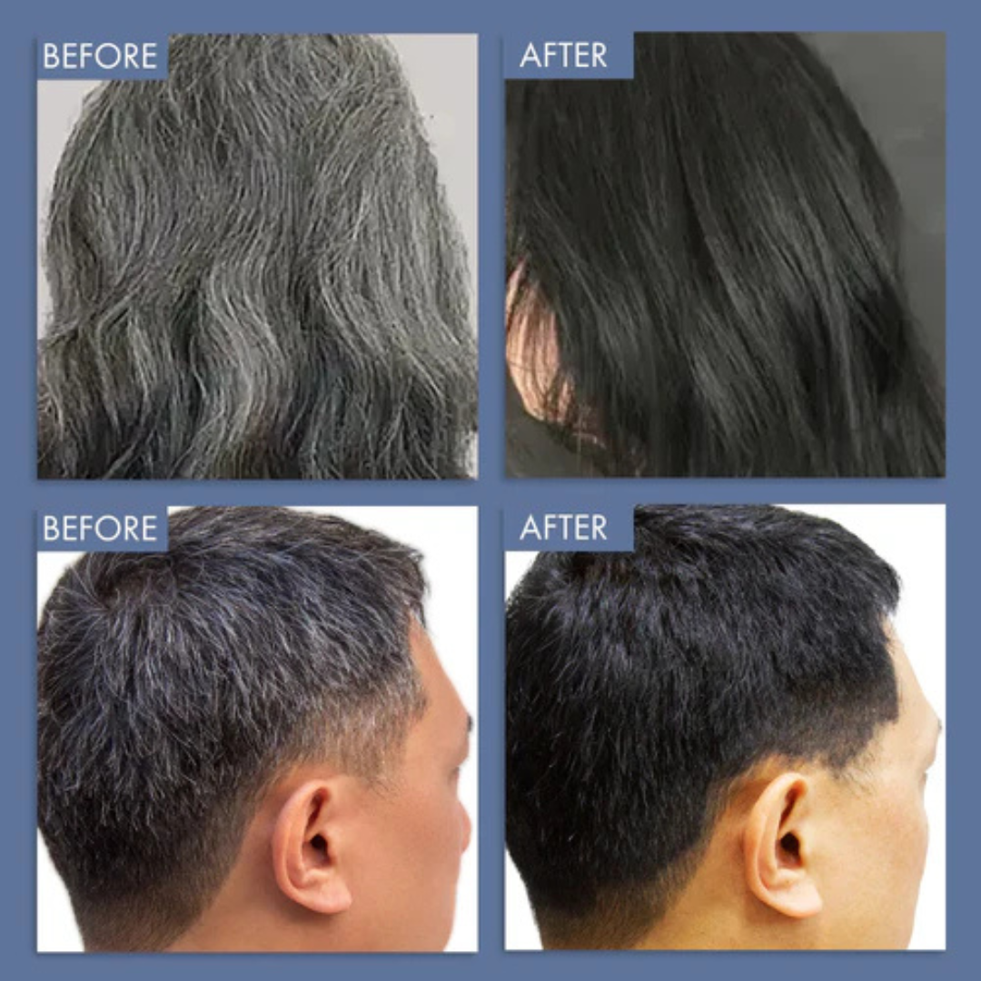 Proskire Anti-Grey Hair Serum – Reverses Grey Hair, Reduces Hair Fall & Restores Hair Color