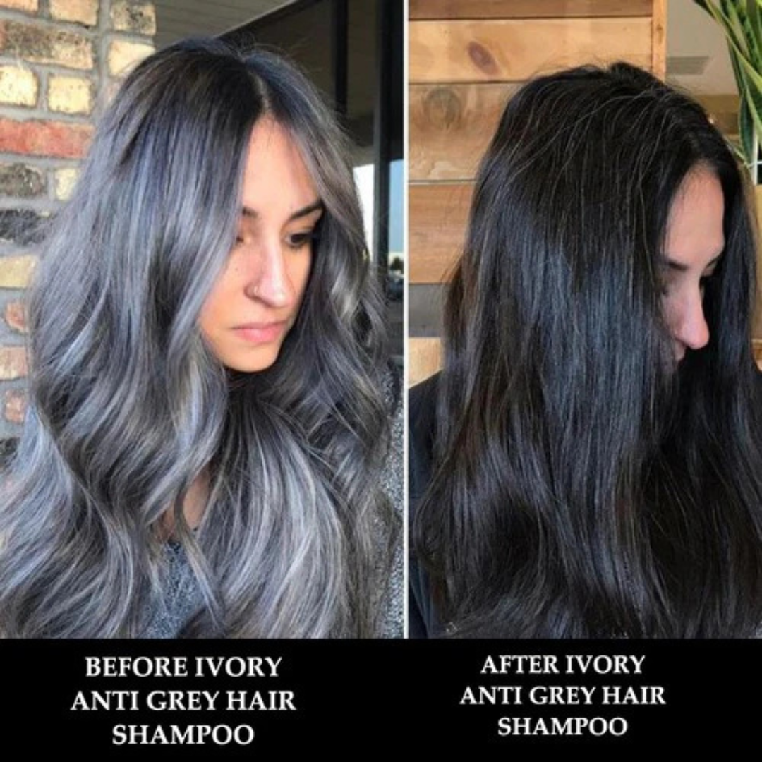 Proskire Anti-Grey Hair Serum – Reverses Grey Hair, Reduces Hair Fall & Restores Hair Color