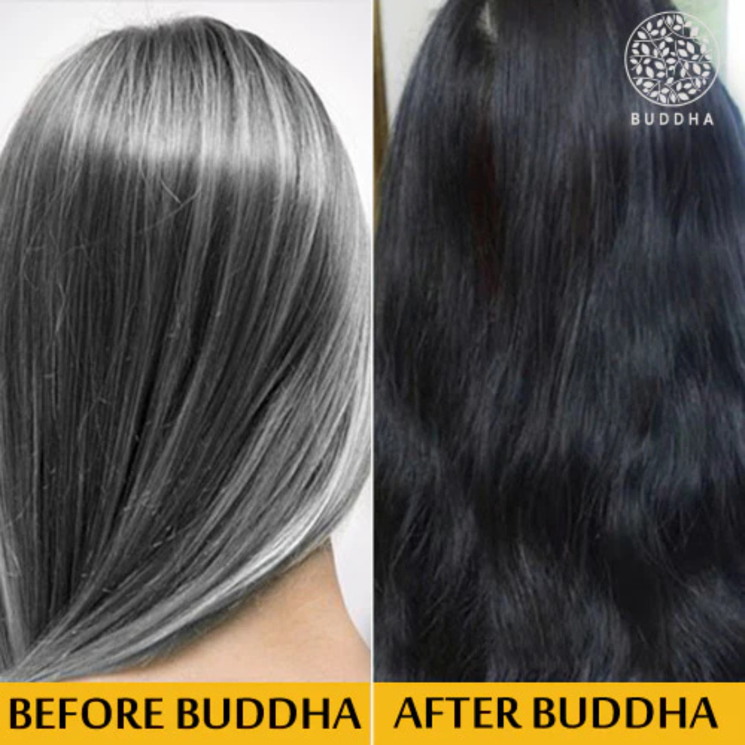 Proskire Anti-Grey Hair Serum – Reverses Grey Hair, Reduces Hair Fall & Restores Hair Color