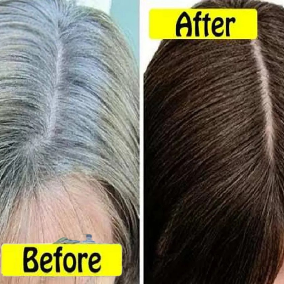 Proskire Anti-Grey Hair Serum – Reverses Grey Hair, Reduces Hair Fall & Restores Hair Color