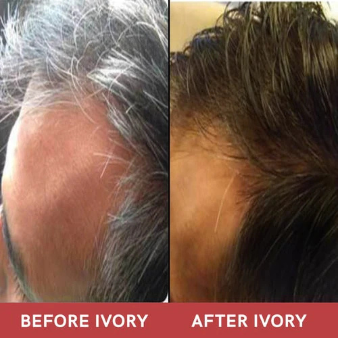 Proskire Anti-Grey Hair Serum – Reverses Grey Hair, Reduces Hair Fall & Restores Hair Color