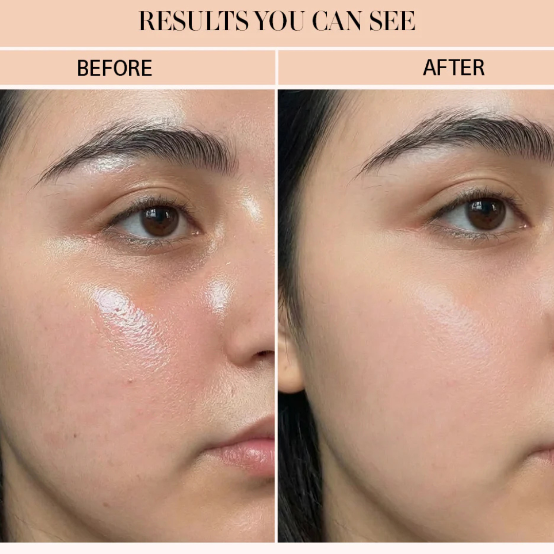 AXIS-Y Triple PDRN Gel Toner | 6+1+1 Advanced Formula with Plant-Based PDRN, Astaxanthin & Vegan Collagen | Strengthens Barrier, Hydrates & Calms Skin