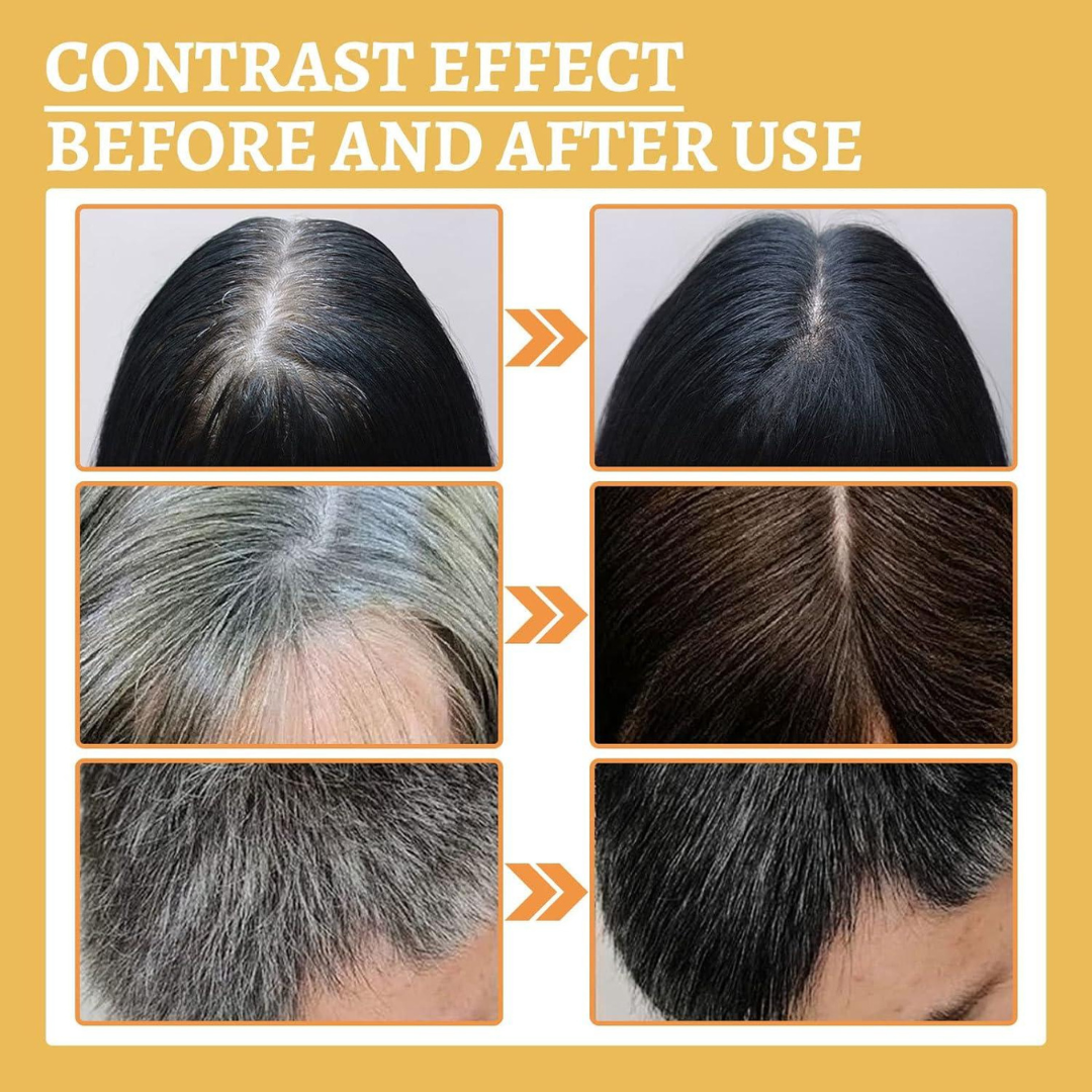 Proskire Anti-Grey Hair Serum – Reverses Grey Hair, Reduces Hair Fall & Restores Hair Color