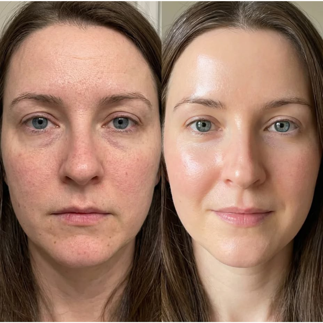 GLAMVEDA Rice & Ceramide Glass Skin Peel-Off Mask – Reveal Smooth, Radiant & Glass-Like Skin – Brightens Dull Skin, Strengthens Barrier, Deeply Hydrates & Nourishes